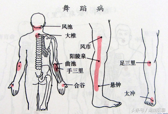 舞蹈男孩生病,10岁孩子患上小舞蹈症