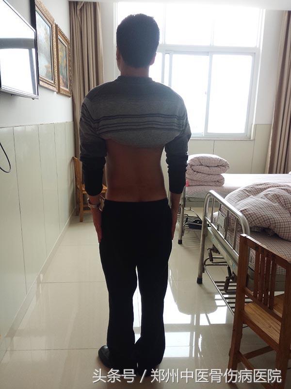 经常坐着办公怎样预防腰椎间盘突出,上班久坐怎么缓解腰椎间盘突出