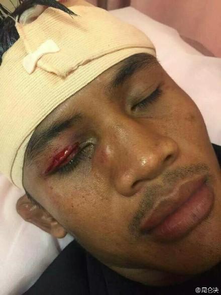 播求被一拳击倒,播求惨遭铁肘爆头