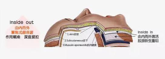 超声刀全部视频,超声刀图解全册