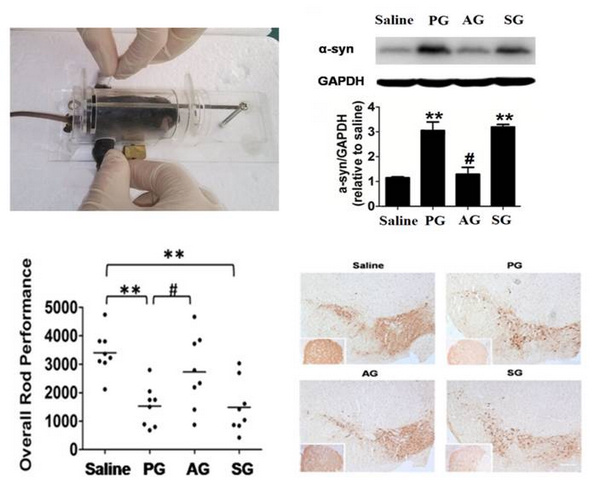 老年人帕金森手抖中医针灸能治吗,针灸治疗帕金森病原理