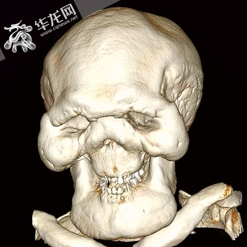 男子怪病困扰二十年,男子被怪病困扰十多年