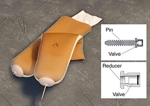 残疾朋友须要注意了：硅胶套，我须要配戴吗？