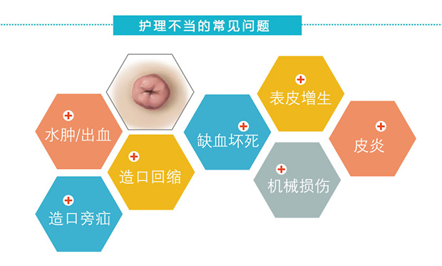 造口脱垂原因及处理方法,造口旁疝会诱发造口脱垂吗