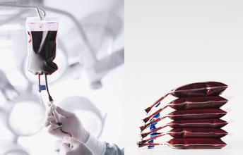 电子输注泵有什么用,电子输注泵有什么作用