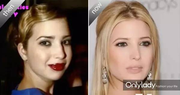 希拉里牙齿怎么样,希拉里的女儿怎么样