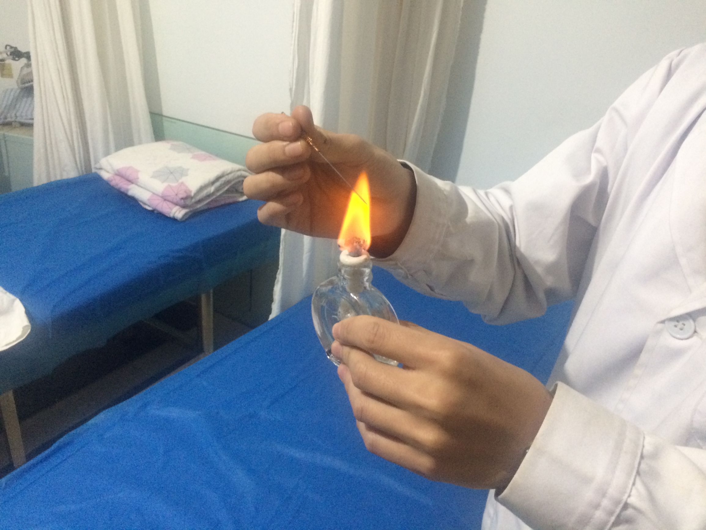 火针治疗狐臭,中医永久治愈狐臭的医案