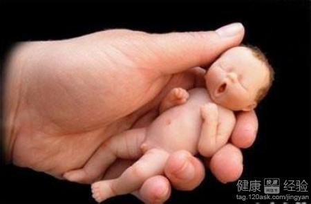 粉丝答疑：发生复发性流产该怎么办？