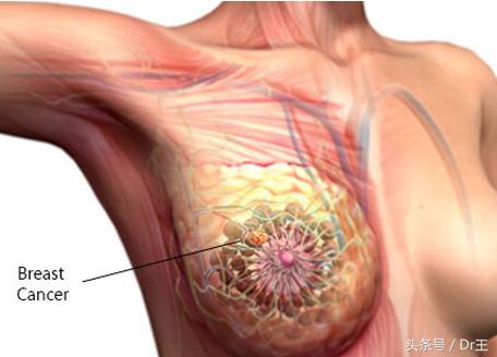 颈部淋巴疼痛但彩超没有显示,颈部肩部肌肉酸痛头晕ct还没事