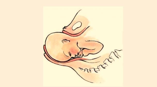 分娩时遇到突发情况怎么办,分娩害怕怎么办