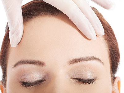 自体脂肪丰额头效果,自体脂肪丰额头效果只有3年