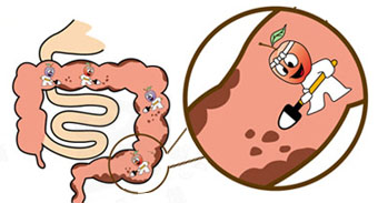 大便硬拉不出，这是热型便秘，1个润通之法，轻松排便不求人