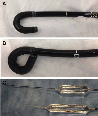 克罗恩病内镜严重程度指数,克罗恩病内镜检查是怎么样的