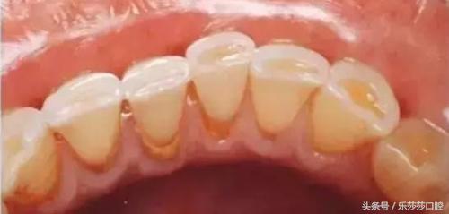 牙医能辨别出换过没换过的牙齿吗,牙医见过最好的牙齿是怎么样的