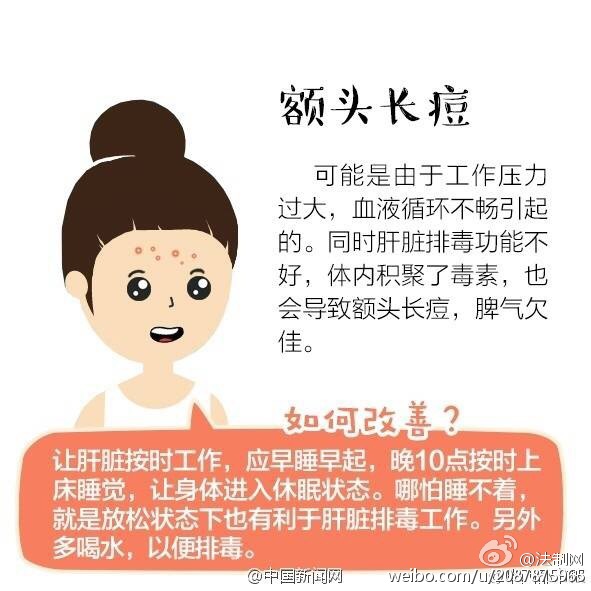 大学生因挤痘引发的一连串事情,挤青春痘导致颅内感染死亡