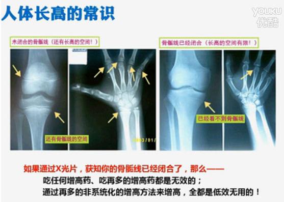 长高的原理及道理,长高生长素是真的吗