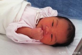 病理性黄疸有没有生命危险,得过黄疸的小孩后期皮肤会发黄吗