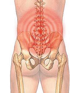 腰疼是有重大疾病吗,腰疼除了腰的问题还有别的原因