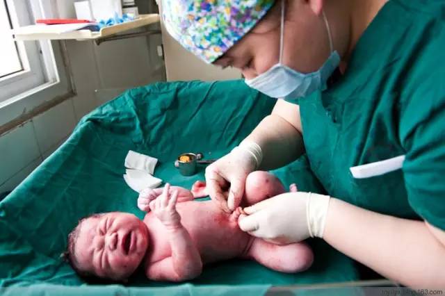 剖腹产恢复很好的照片,剖腹产完全恢复照片