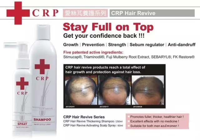 清洗头皮才是洗头的关键!