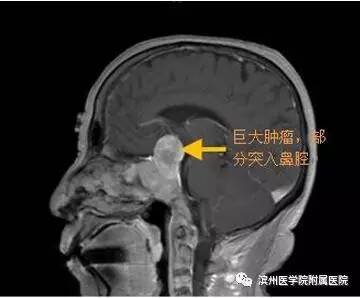 滨医附院神经介入外科,滨医神经外科住院部