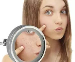 脸上各个部位长痘原因一张图,战豆豆