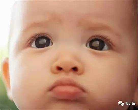 宝宝严重性贫血该如何补,宝宝贫血最明显的5个征兆