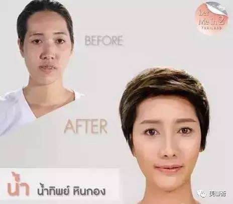 揭秘韩国整容术发达的原因,韩国整容业发达背后的原因