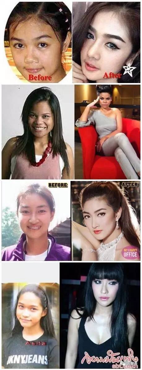 揭秘韩国整容术发达的原因,韩国整容业发达背后的原因