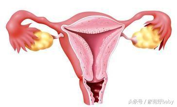 产后子宫快速恢复的方法，是什么在阻止子宫的恢复？