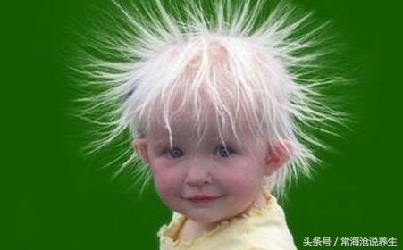 长白头发了怎么办,40岁白头发突然增多如何调理