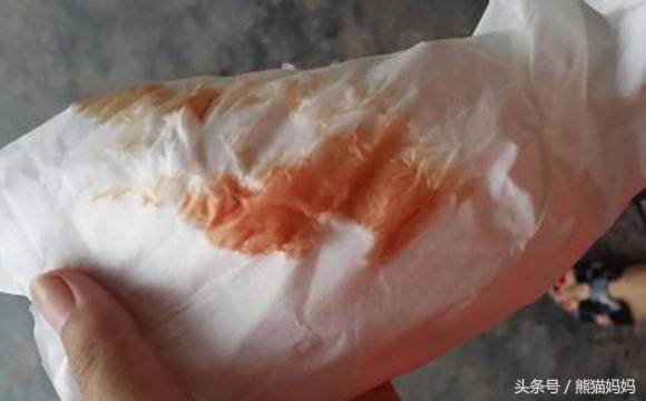 分娩前见红是什么症状,分娩前见红一般多久生