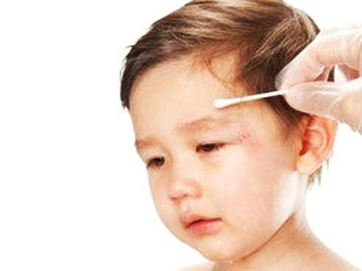 几个宝宝常见意外及对策