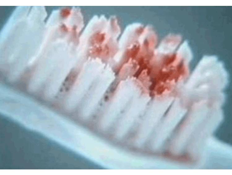 看牙拍片子影响备孕吗,备孕期间可以治牙补牙吗