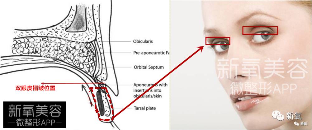 连范冰冰的脸都驾驭不了欧式平行大双，为什么？