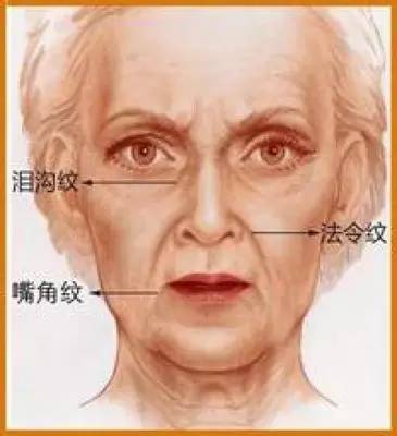 有泪沟怎么办最有效方法,有泪沟怎么办