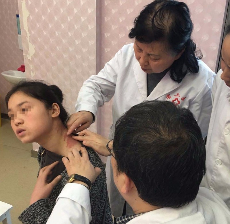 胎记怎样在家治疗,胎记能用中药祛除吗