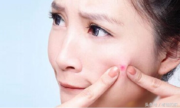 祛痘中药自制面膜,中草药面膜祛痘痘