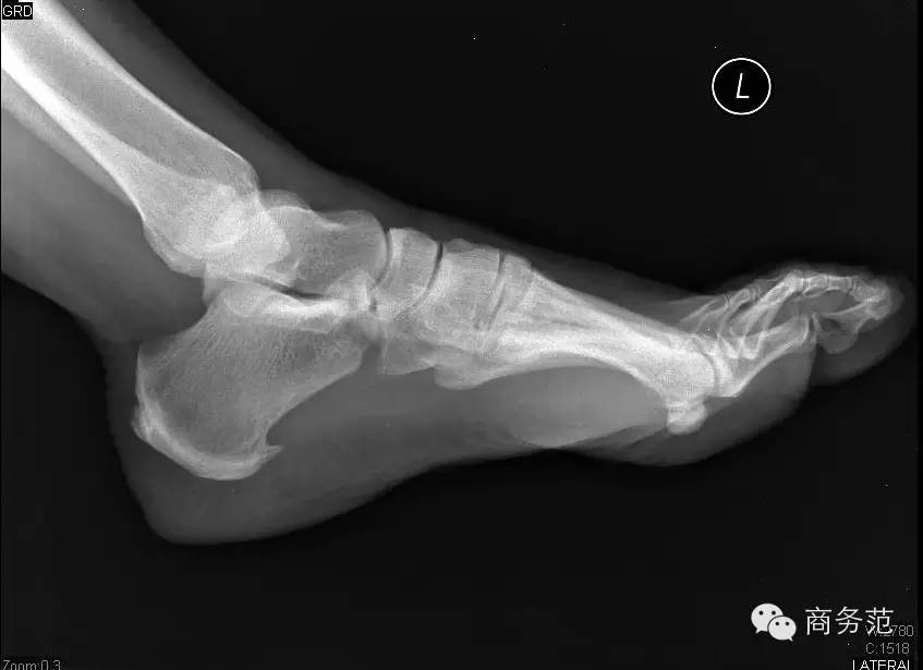 ugg那么贵为什么,冬天不要买哪些衣服