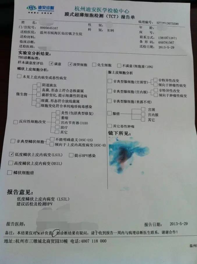 宫颈癌筛查tct报告单怎么看,宫颈癌筛查报告单tct包括什么