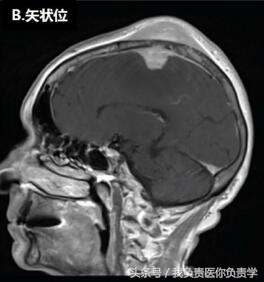 每日病例：头顶是莫名其妙长了个“包”，来看看医生怎么诊断？