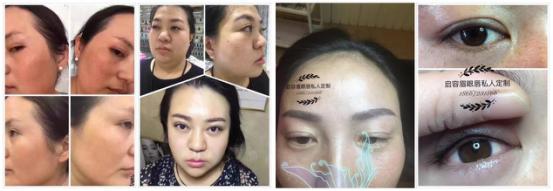 温婉细致，精雕细琢，纹饰美容的美丽播种者---唐启容