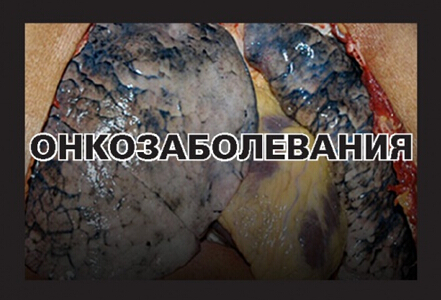 俄罗斯禁烟了吗,俄罗斯禁烟后果