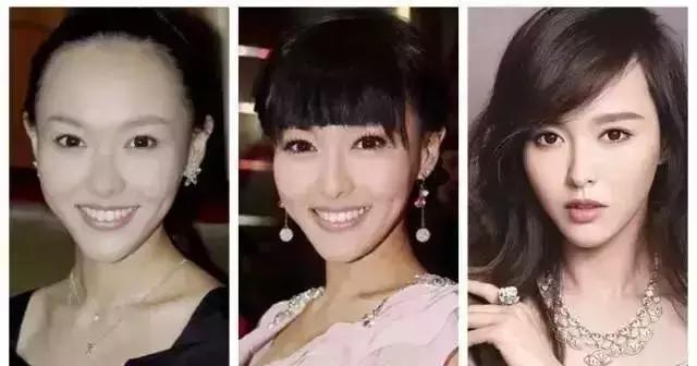 发际线两边掉头发用什么洗发水,用什么洗发水防止男生发际线后移