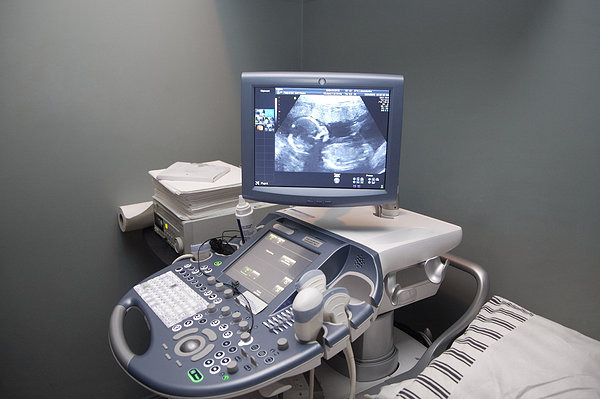 b超单怎么看差不多要生了,从b超单怎么判断要生了