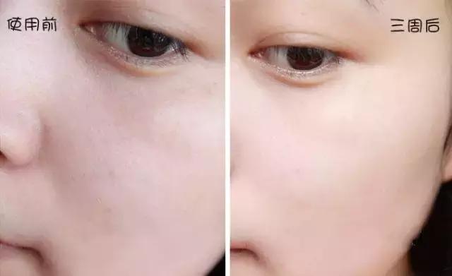 无美颜无滤镜遮毛孔,高级美颜相机祛皱美白