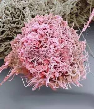 Word天！想不到癌细胞如此惊艳