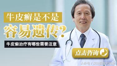银屑病患者适合生二胎吗,孕妇长银屑藓要怎么处理