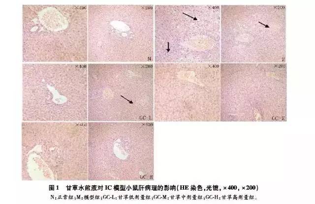 甘草水煎液对-萘异硫氰酸酯诱导的肝内胆汁淤积性损伤的防治及其机理研究