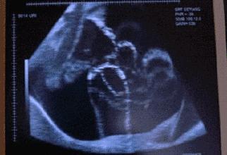 孕期宝宝健康成长孕妈的身体反应,孕妇健康宝宝健康